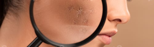 Preview: panoramic shot of magnifier near young woman with problem skin isolated on beige