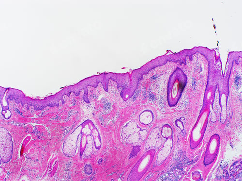 Vista previa: H&E stain, light microscopy, normal skin of scalp