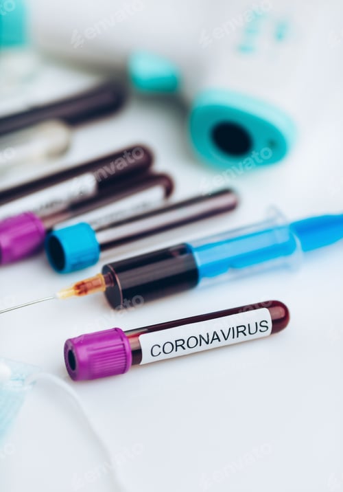 Preview: Laboratory sample of the novel Coronavirus