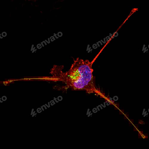 Preview: Triple negative breast cancer cell undergoing retraction and apoptosis