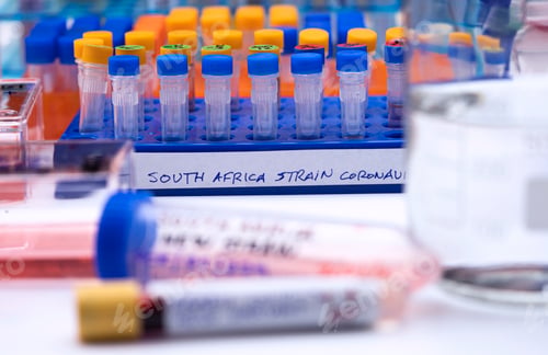 Preview: Several vials positive for covid-19 infection of the new variant in the south africa