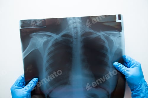 Preview: Medical doctor hand holding a x ray image.