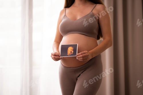 Preview: Unrecognizable caucasian pregnant woman holding ultrasound photo
