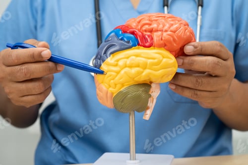 Preview: Alzheimer disease, Asian doctor holding brain anatomy model
