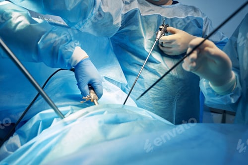 Preview: Surgeons Performing Laparoscopic Surgery with Specialized Tools