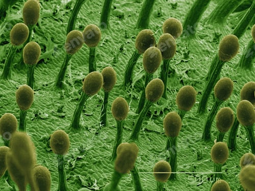 Preview: Coloured SEM of sticky hairs on sundew carnivorous plant