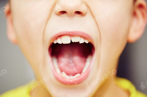 Preview: Teeth