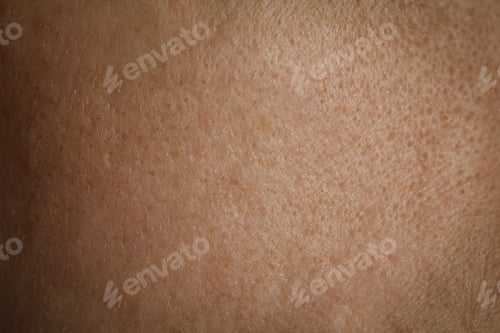 Preview: Texture of human skin as background, closeup view