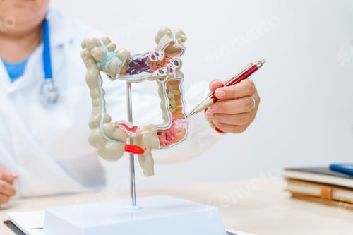 Preview: A doctor holds a human colon anatomy model, demonstrating the digestive system