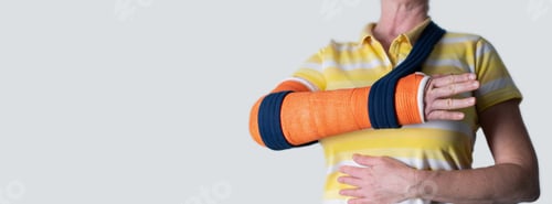 Preview: woman with broken right arm in Fiberglass casts to hold broken bones in place until they heal
