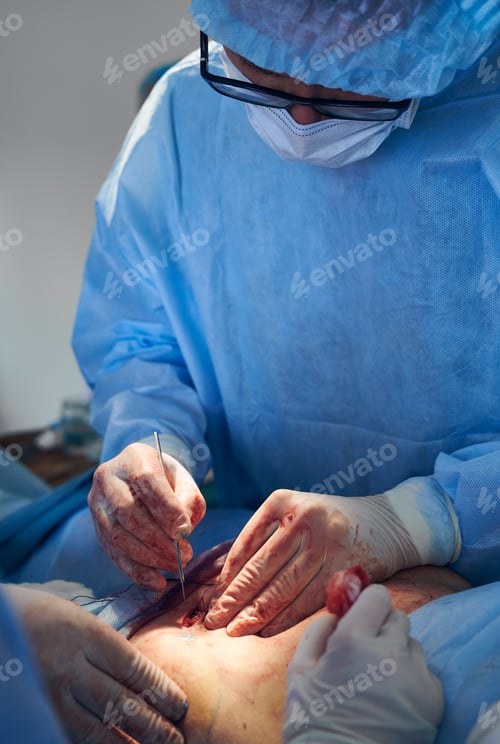 Preview: Male doctor performing abdominoplasty surgery in clinic.