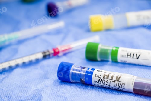 Preview: Selective focus shot of positive HIV blood specimen on test tube in the laboratory