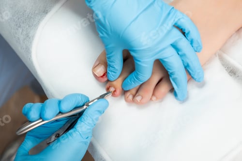 Preview: Professional medical pedicure using special nail instruments in the clinic