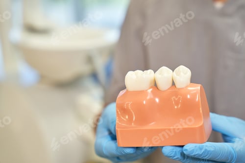 Preview: Visual plastic prop of gum and teeth presented by dentist
