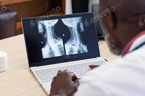 Preview: African american male doctor using laptop with radiograph on screen at doctor's office
