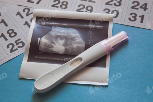 Preview: Ultrasound scan of an unborn baby of fifth week with a pregnancy test and calendar on the blue