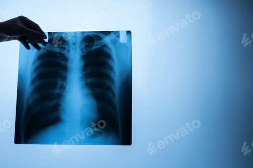 Preview: Specialist doctor examining x-ray film of patient.