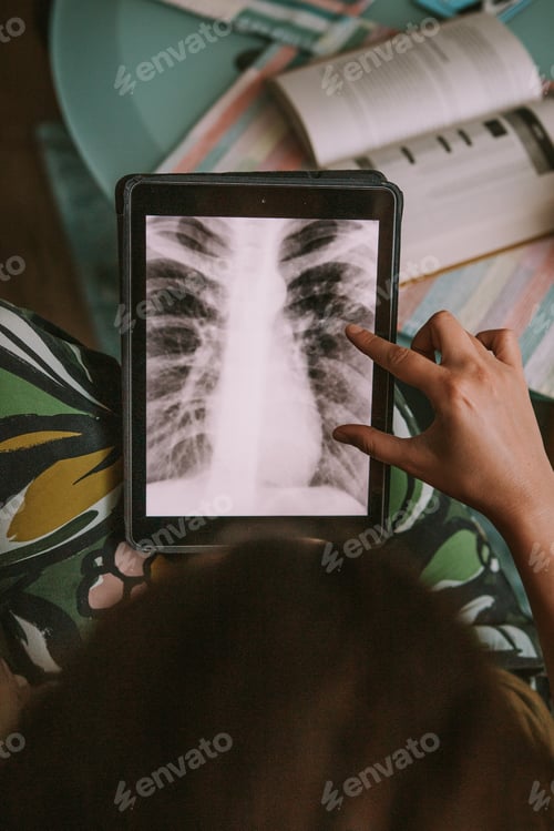 Preview: Girl analyzing a chest radiography