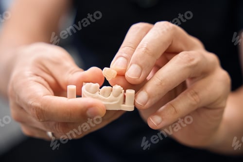 Preview: Prosthetist demonstrates a model for dental prosthetics