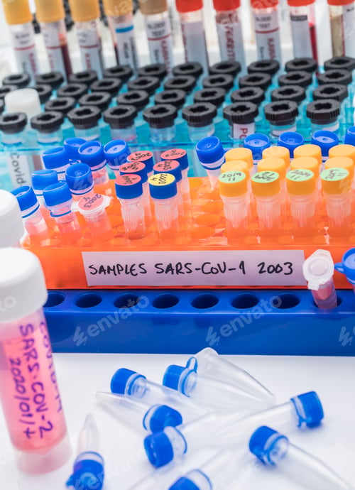 Preview: Vials with samples of SARS-COV-1 prepared cold in a laboratory
