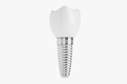 Preview: Dental Implant: Screw-In Tooth