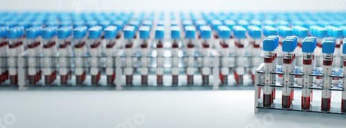 Preview: Coronavirus Covid19 test tubes in a rack. Medical screening and Covid tests production
