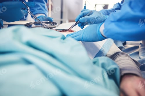 Preview: Surgery, group hands and patient operation, hospital emergency service or doctors teamwork on wound