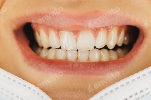 Preview: Close Up Of A Teeth Smiling Mouth Of A Woman