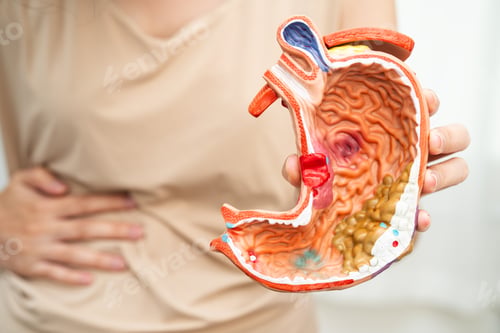 Preview: Stomach disease, Asian woman holding anatomy model for treatment in hospital.