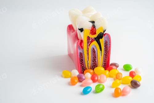 Preview: Tooth decay model with colorful candy sweet food on white background with copy space.