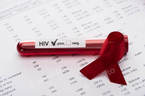 Preview: positive hiv blood sample test on paper result form with awareness ribbon