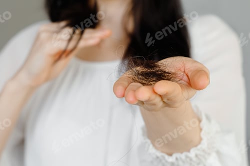 Preview: hair loss problem on hand isolated on white background