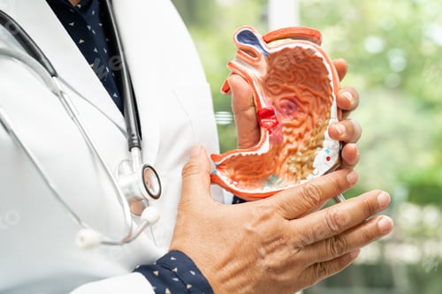 Preview: Stomach disease, doctor holding anatomy model for study diagnosis and treatment in hospital.