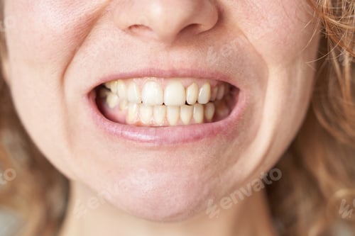 Preview: Female Caucasian adult close up teeth smile with natural dental alignment