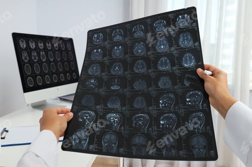 Preview: MRI images of a human head in the hands of a doctor