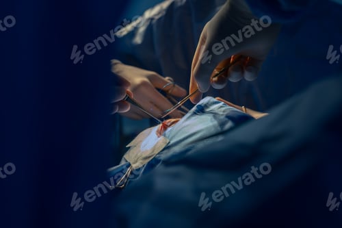 Preview: Blepharoplasty, plastic surgery operation for correcting defects, deformities, and disfigurations