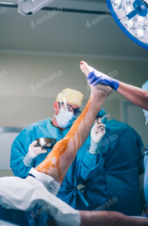 Preview: Doctors prepare knee knee operation.