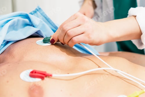 Preview: ECG electrodes on the patient