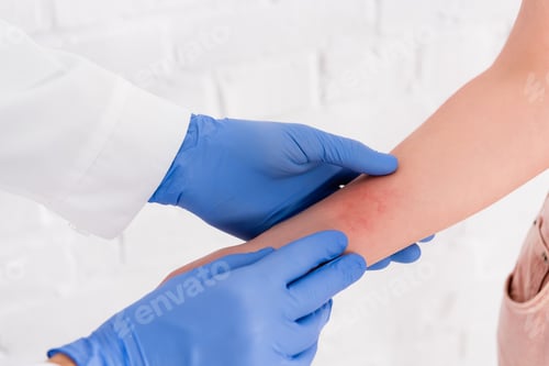 Preview: Cropped view of doctor inspecting arm of woman with allergy