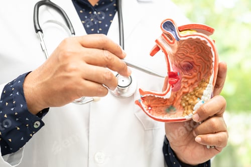 Preview: Stomach disease, doctor holding anatomy model for study diagnosis and treatment in hospital.