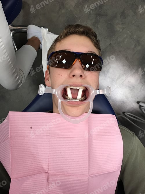 Preview: Braces
