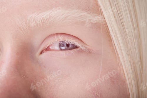 Preview: Albino woman with blue eyes