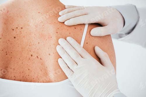 Preview: cropped view of dermatologist in latex gloves examining woman with skin disease isolated on white