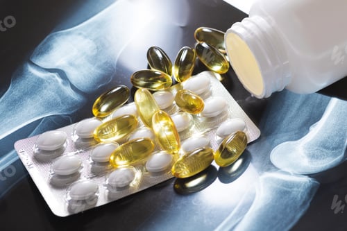 Preview: Close-up of X-ray image and different pills and capsules
