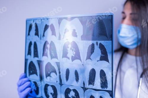 Preview: a doctor holds an MRI scan of the lungs with a coronavirus lesion in his hands in gloves