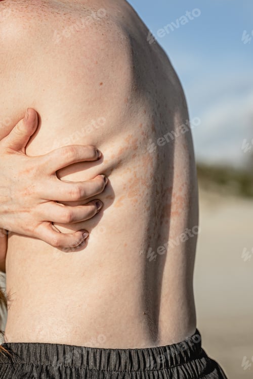 Preview: scratching itchy back