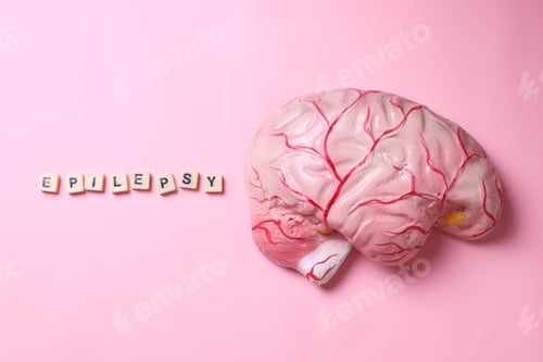 Preview: Brain anotomical model with epilepsy lettering