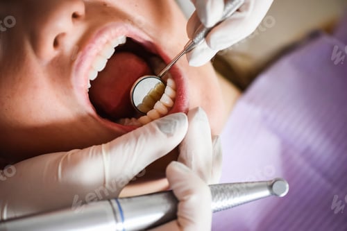 Preview: Dental Check