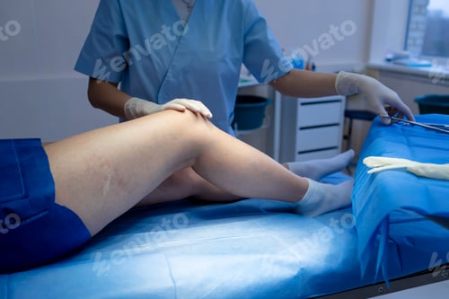 Preview: Medical professional examining leg veins with gentle palpation.