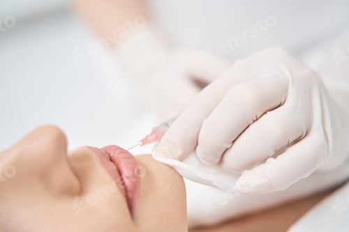 Preview: Woman receiving lip injection in cosmetology clinic